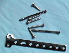 Leg plate & screws